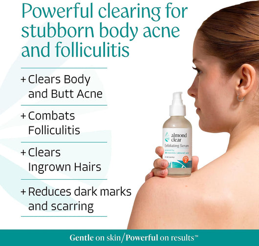 Mandelic Acid Serum