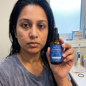 Purivia Esophageal & Stomach Lining Formula